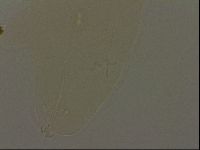 Pilatobius oculatus image