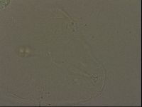 Pilatobius oculatus image
