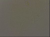 Pilatobius oculatus image