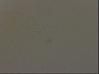 Pilatobius oculatus image