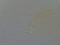 Pilatobius oculatus image
