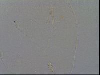 Pilatobius oculatus image