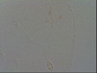 Pilatobius oculatus image