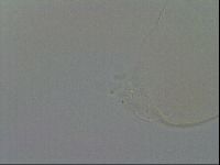 Pilatobius oculatus image