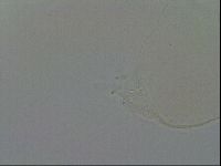 Pilatobius oculatus image