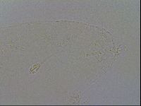 Pilatobius oculatus image
