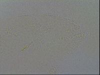 Pilatobius oculatus image