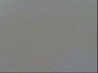 Pilatobius oculatus image