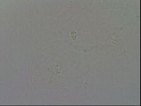 Pilatobius oculatus image