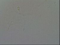 Pilatobius oculatus image