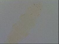 Pilatobius oculatus image