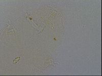 Pilatobius oculatus image