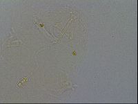 Pilatobius oculatus image