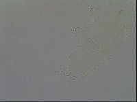 Pilatobius oculatus image