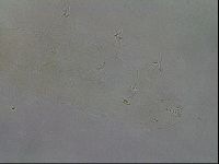 Pilatobius oculatus image