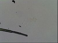 Pilatobius oculatus image