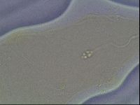 Pilatobius oculatus image