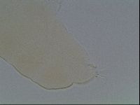 Pilatobius oculatus image