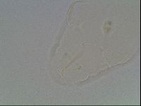 Pilatobius oculatus image