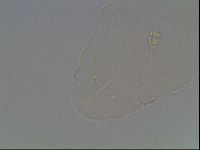 Pilatobius oculatus image