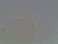 Pilatobius oculatus image