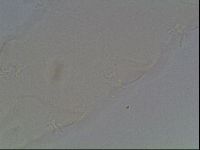 Pilatobius oculatus image