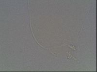 Pilatobius oculatus image