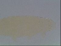 Pilatobius oculatus image