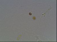 Pilatobius oculatus image