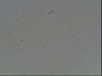 Pilatobius oculatus image