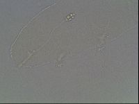 Pilatobius oculatus image