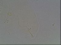 Pilatobius oculatus image
