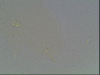 Pilatobius oculatus image
