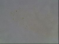 Pilatobius oculatus image