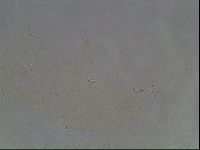 Pilatobius oculatus image