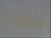Pilatobius oculatus image