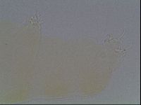 Pilatobius oculatus image