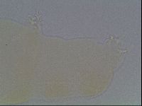 Pilatobius oculatus image