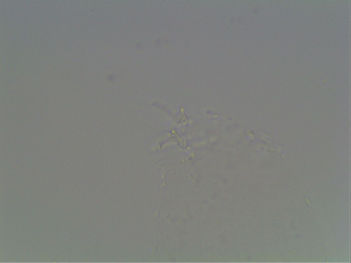 Pilatobius oculatus image