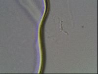 Pilatobius oculatus image