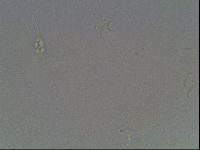 Pilatobius oculatus image