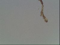 Pilatobius oculatus image