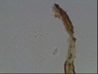 Pilatobius oculatus image