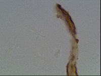 Pilatobius oculatus image