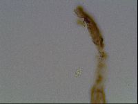 Pilatobius oculatus image