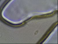 Pilatobius oculatus image