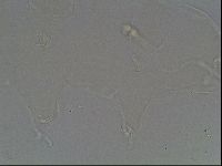 Pilatobius oculatus image