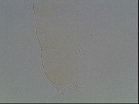 Pilatobius oculatus image