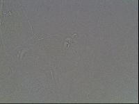 Pilatobius oculatus image