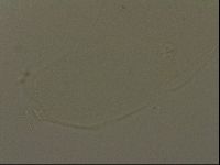Pilatobius oculatus image
